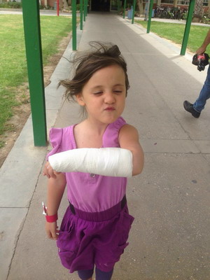 broken arm